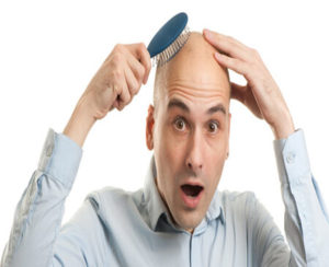 male-baldness