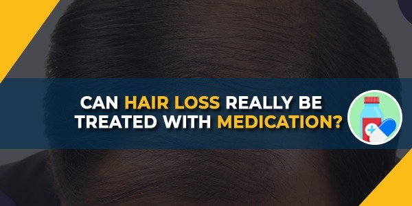 Can hair loss really be treated with medication?