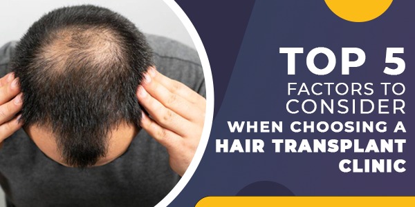 Top 5 Factors to Consider When Choosing a Hair Transplant Clinic