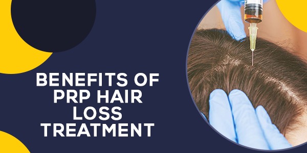 BENEFITS OF PRP HAIR LOSS TREATMENT
