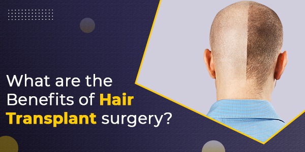 What are the Benefits of hair transplant surgery?