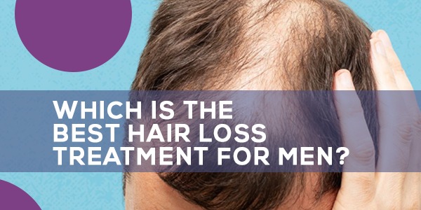 Which is the Best Hair Loss Treatment for Men?