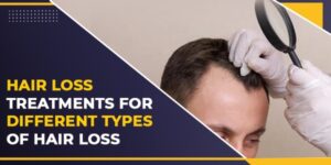 Didfferent Types of Hair Loss