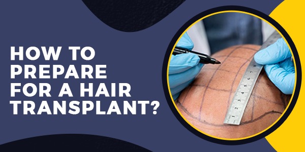 How to Prepare for a Hair Transplant?