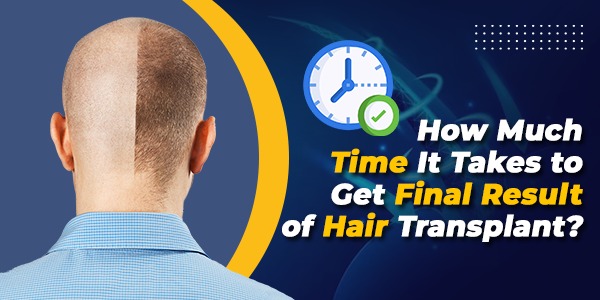 How Much Time It Takes to Get Final result of Hair Transplant?