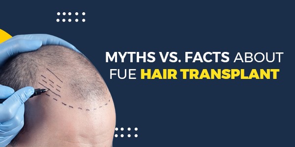 Myths vs. Facts about FUE Hair Transplant