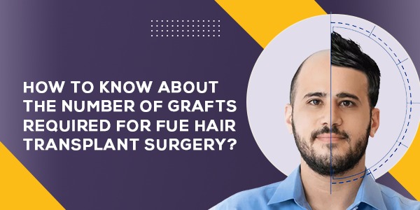 How To Know About the Number Of Grafts Required For FUE Hair Transplant Surgery?