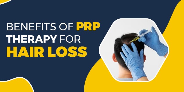 Benefits of PRP Therapy for Hair Loss