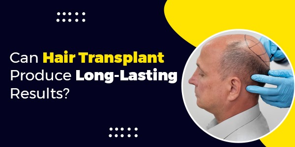 Can Hair Transplant Produce Long-Lasting Results?
