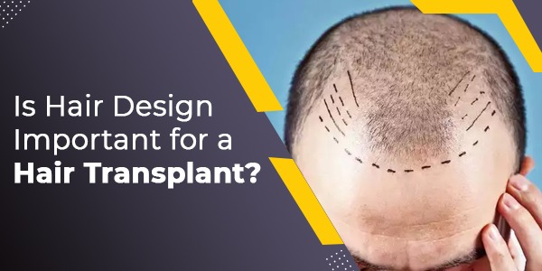Is Hair Design Important for a Hair Transplant?