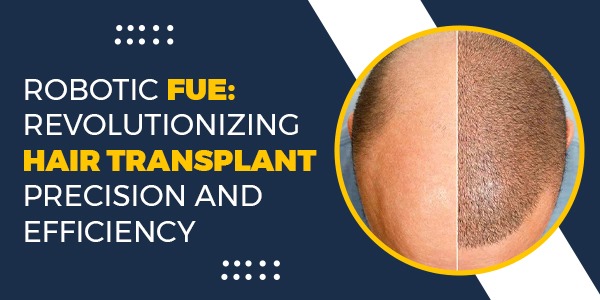 Robotic FUE: Revolutionizing Hair Transplant Precision and Efficiency