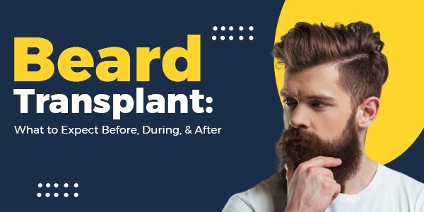 Beard Transplant: What to Expect Before, During, & After