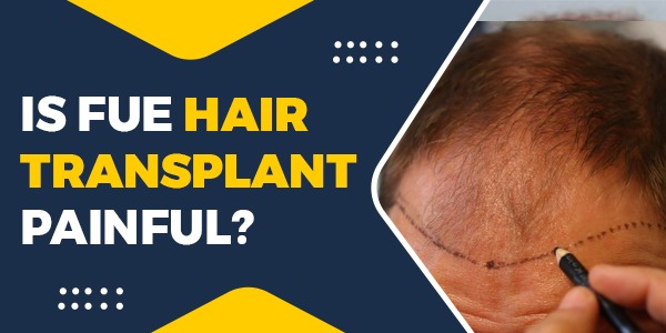 Is FUE Hair Transplant Painful?