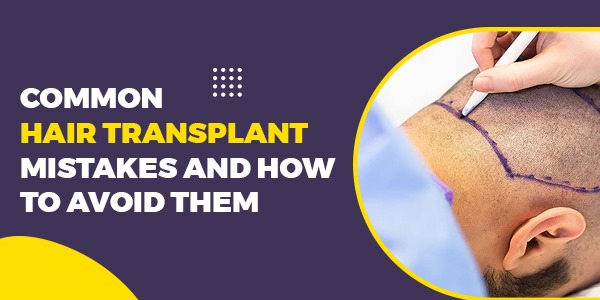 Common Hair Transplant Mistakes and How to Avoid Them