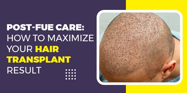 Post-FUE Care: How to Maximize Your Hair Transplant Results