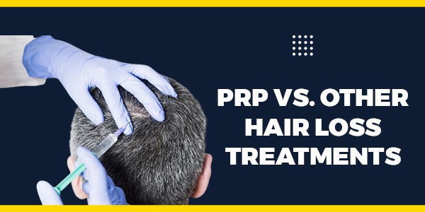 PRP vs. Other Hair Loss Treatments