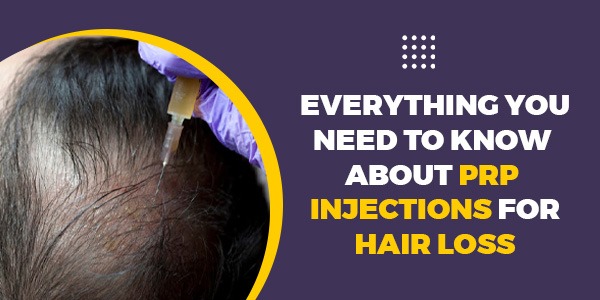 Everything You Need to Know About PRP Injections for Hair Loss