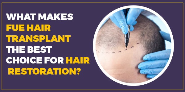 What Makes FUE Hair Transplant the Best Choice for Hair Restoration?