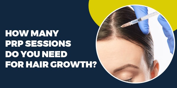 How Many PRP Sessions Do You Need for Hair Growth?