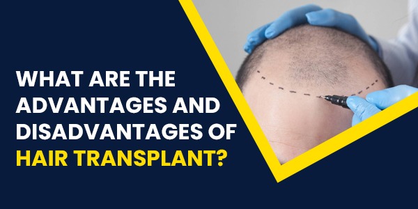 What are the advantages and disadvantages of hair transplant?