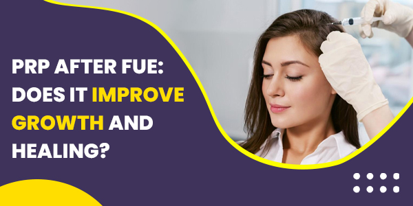 PRP After FUE: Does It Improve Growth and Healing?