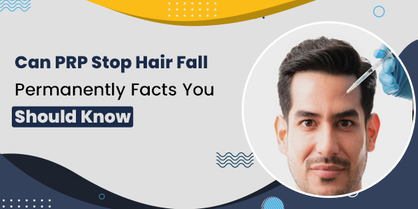 Can PRP Stop Hair Fall Permanently Facts You Should Know