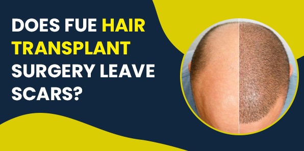 Does FUE Hair Transplant Surgery Leave Scars?