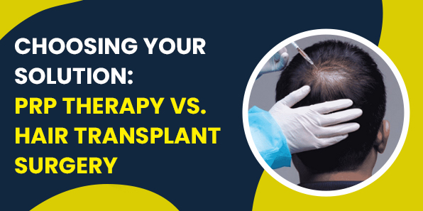 Choosing Your Solution: PRP Therapy vs. Hair Transplant Surgery