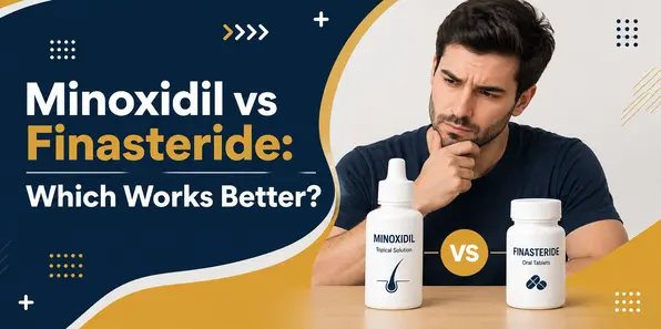 Minoxidil vs Finasteride: Which Works Better?